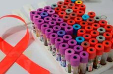 Estigma que persiste sobre VIH dificulta adecuada atención médica en México
