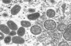 Detectan primer caso de viruela símica en Nuevo León