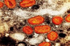 En 2023 se confirmó ya un nuevo caso de viruela símica en SLP