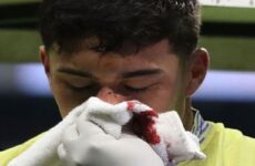 Alejandro Zendejas sufrió una fractura en la nariz