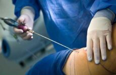 Alerta Coepris por médico sin certificación para cirugías estéticas
